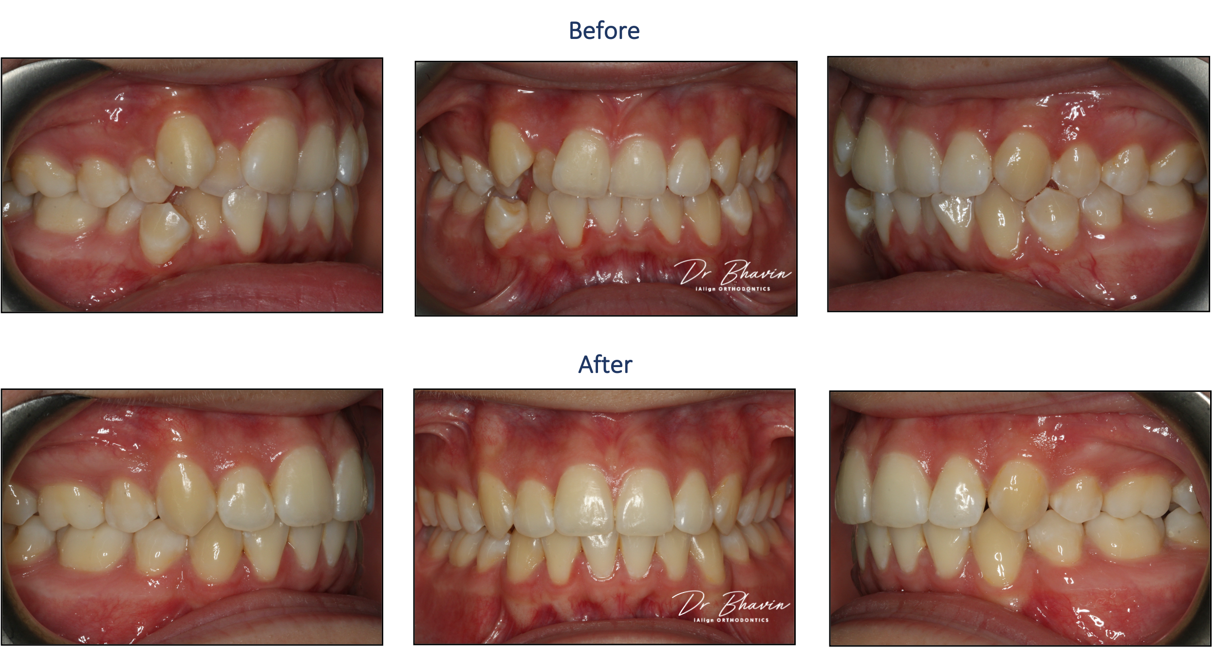 Smile Transformation